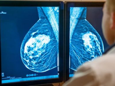 Breast Imaging