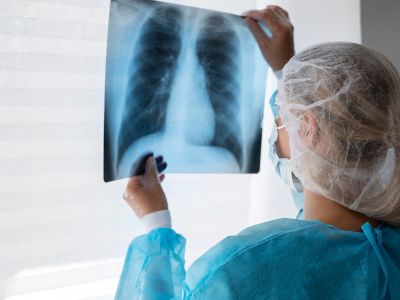 Digital X-Ray