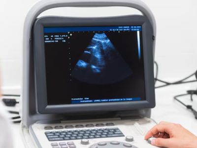 Sonography