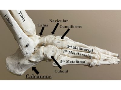 Calcaneum/Heel