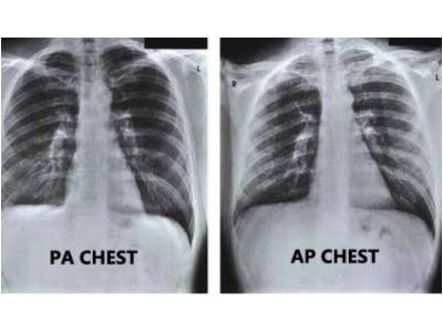 Cheat PA/AP/LAT