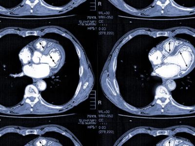 CT Scan at Raaya Diagnostic Centre