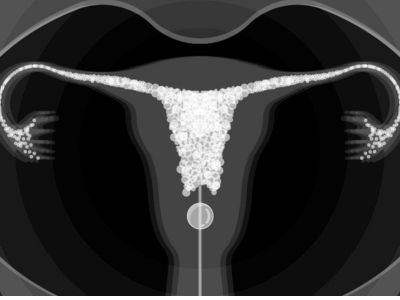 Hysterosalpingography