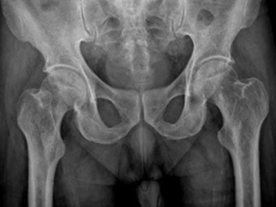 CT Scan at Raaya Diagnostic Centre