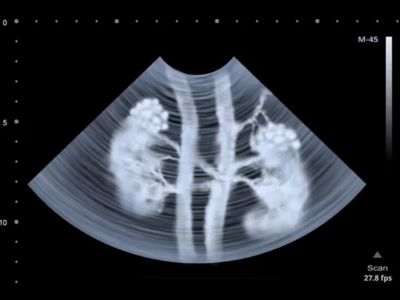 CT Scan at Raaya Diagnostic Centre