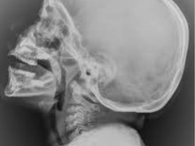CT Scan at Raaya Diagnostic Centre