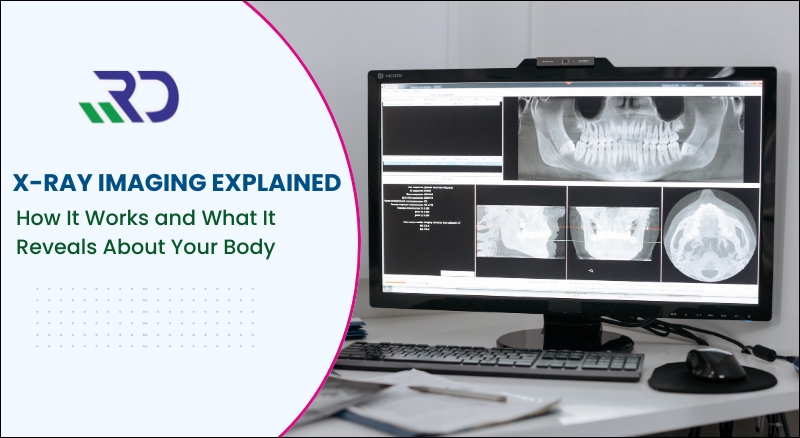 X Ray Imaging explained