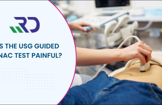 USG Guided FNAC